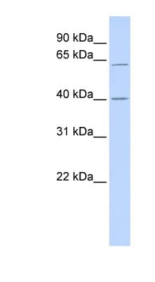 Polyclonal Rabbit anti-Human TRIT1 Antibody (aa179-228, WB)