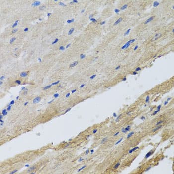 FECH / Ferrochelatase Antibody