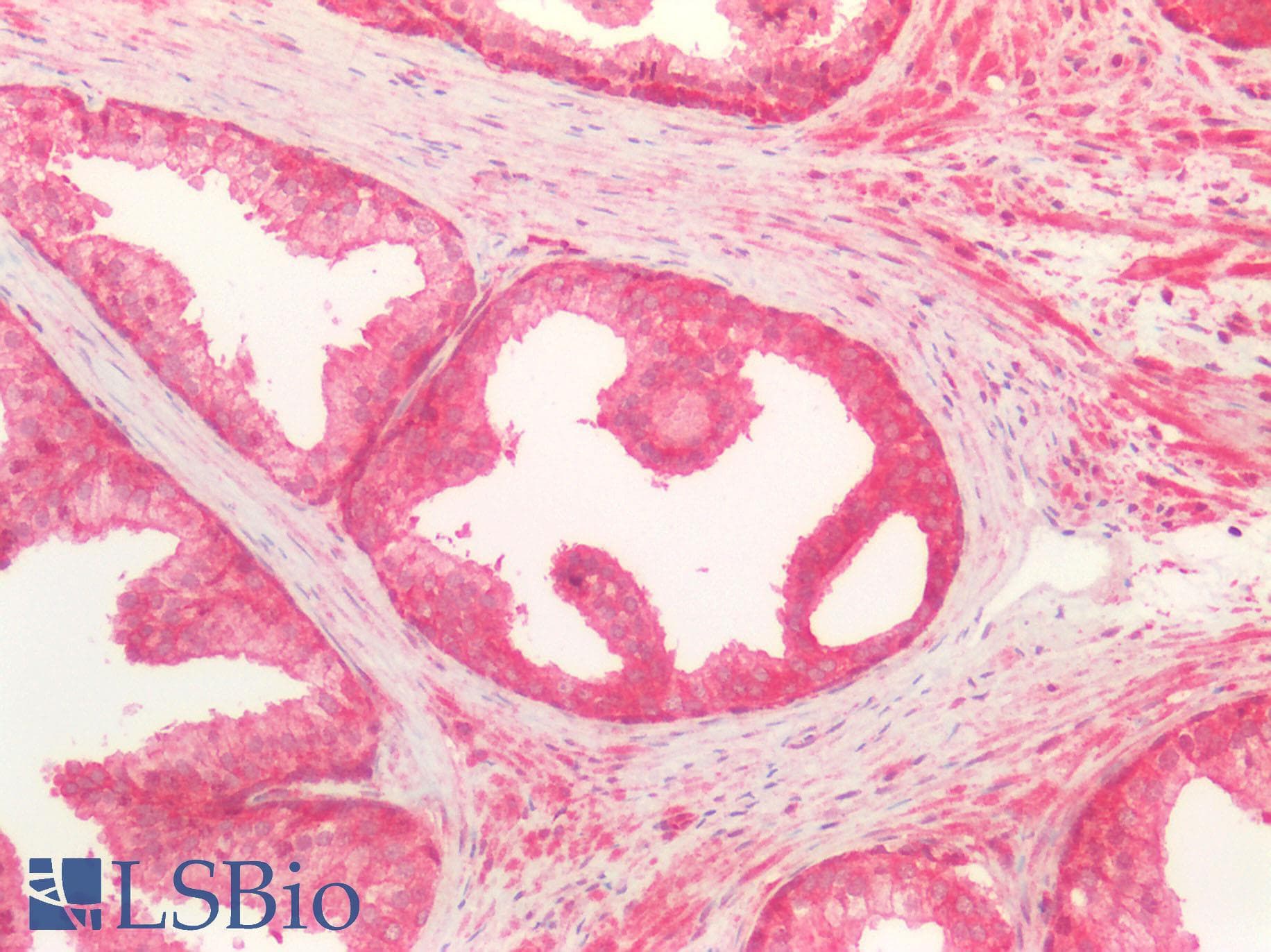 Polyclonal Rabbit anti-Human SMO / Smoothened Antibody (IHC, IF, WB)