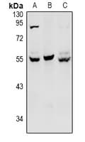 HNF4 Alpha+Gamma Antibody