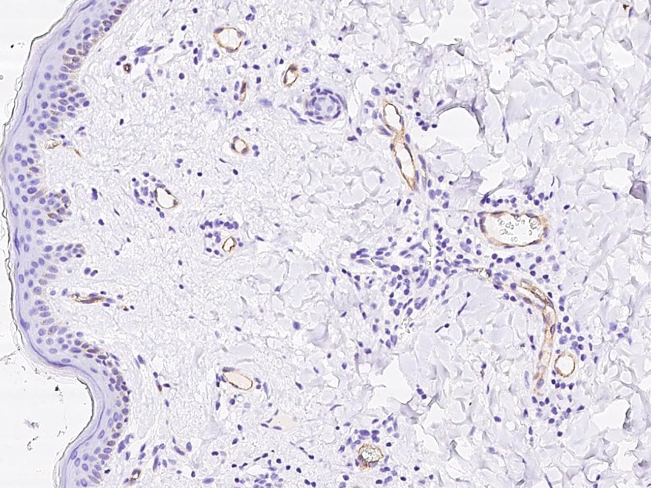 PV1 / PLVAP Antibody