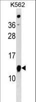 ATPIF1 / ATPI Antibody (aa8-35)