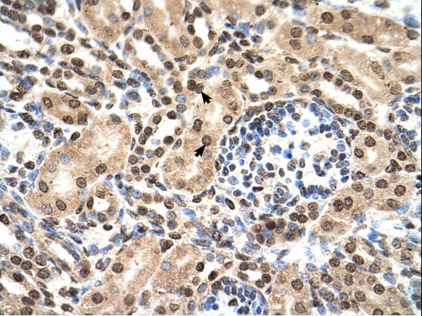 Polyclonal Rabbit anti-Human IFIT3 Antibody (aa51-100, IHC, WB)