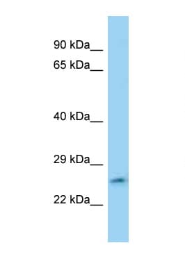FAM71C Antibody (aa74-123)