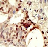DNMT3L Antibody (aa357-388)