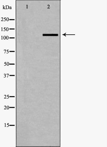 SLC4A4 / NBC1 Antibody