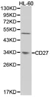 Polyclonal Rabbit anti-Human CD27 Antibody (IHC, WB)