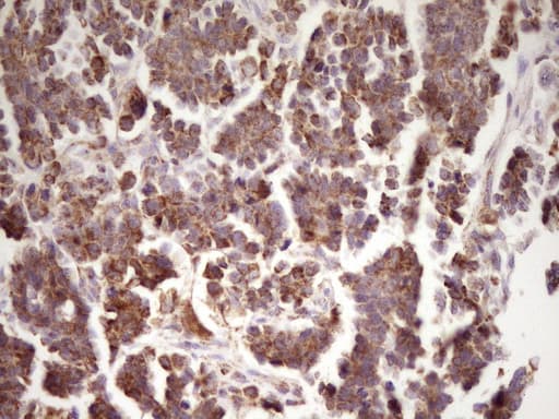 Monoclonal Mouse anti-Human LRRC6 Antibody (clone OTI7E9, IHC)