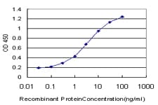 TWF1 / PTK9 Antibody (clone 1E2)