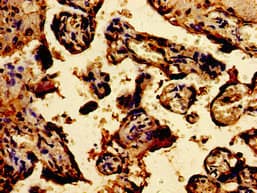 TPT1 / TCTP Antibody