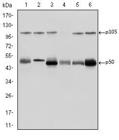 Monoclonal Mouse anti-Human NFKB1 / NF-Kappa-B Antibody (clone 5D10, IHC, WB)