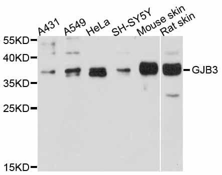 GJB3 / CX31 / Connexin 31 Antibody