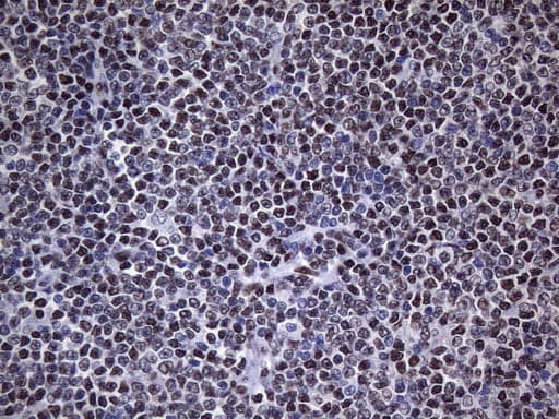 HnRNP A0 Antibody (aa139-183, clone OTI8H8)