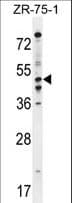 PDE7B Antibody (aa421-450)