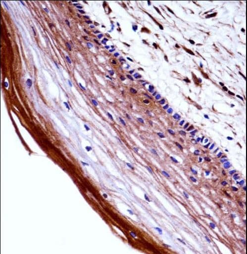 IHC-plus™ PGF / PLGF Antibody (aa120-148)