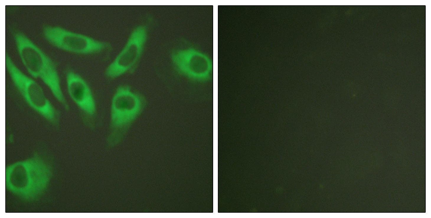 RPS6 / Ribosomal Protein S6 Antibody (p240)