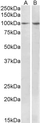 IHC-plus™ BCAR1 / p130Cas Antibody (aa189-201)