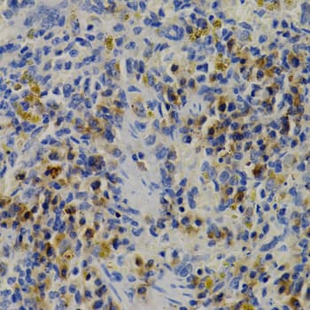 DNMT3B Antibody
