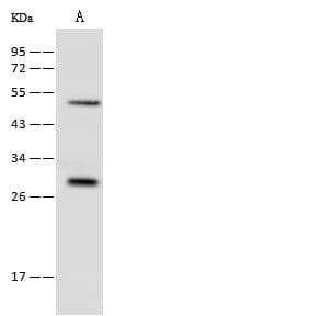 RAB8B Antibody