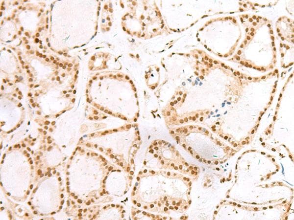 Treacle / TCOF1 Antibody