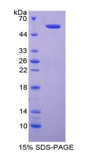 Human DIAPH1 Protein (Recombinant His-GST)