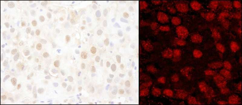 Polyclonal Rabbit anti-Human PARP1 Antibody (aa50-100, IHC, IF, WB)