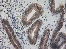 PDXK / PNK Antibody (clone OTI5H5)
