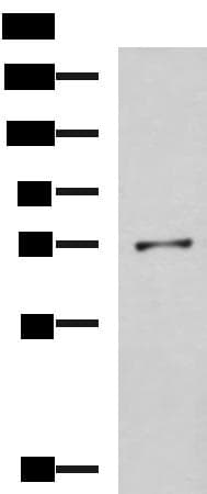 Polyclonal Rabbit anti-Human GSTCD Antibody (IHC, WB)