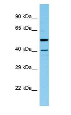 Polyclonal Rabbit anti-Rat HAT1 Antibody (aa40-89, WB)