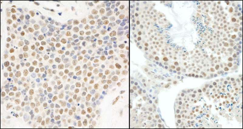 Polyclonal Rabbit anti-Human HNRNPUL1 Antibody (aa50-100, IHC, WB)