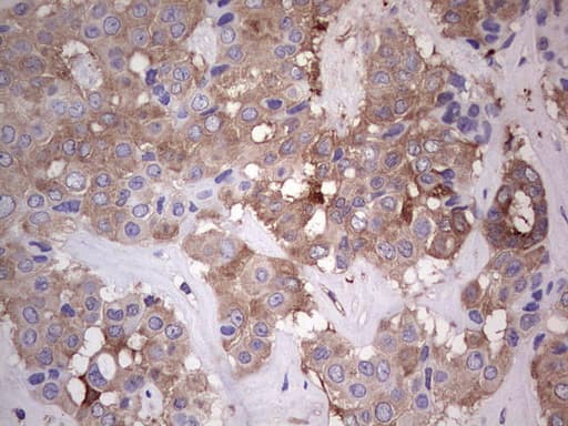 Monoclonal Mouse anti-Human PKM2 Antibody (clone 1F12, IHC, WB)