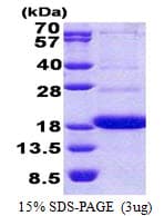 Human CD300A Protein (Recombinant His)