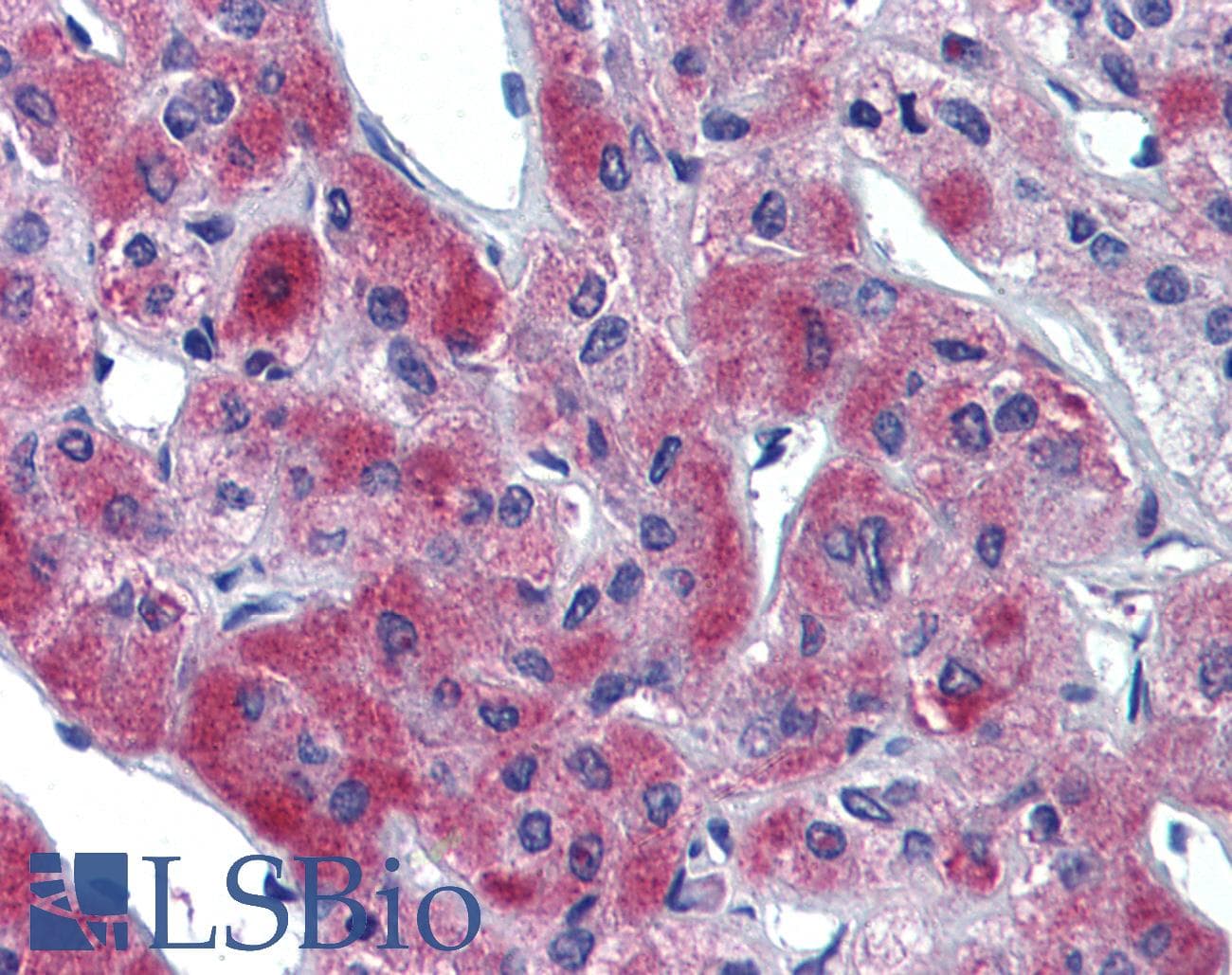 IHC-plus™ SLC39A11 / ZIP11 Antibody