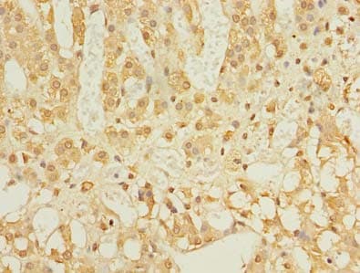LDAH Antibody