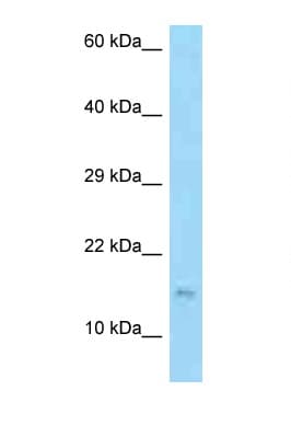 Polyclonal Rabbit anti-Human EDDM3B Antibody (aa71-120, WB)