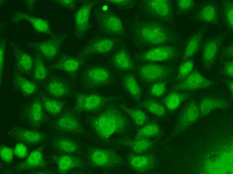 Polyclonal Rabbit anti-Human RAD17 Antibody (IHC, IF, WB)