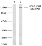 Polyclonal Rabbit anti-Human NFKB2 Antibody (IHC, IF, WB)