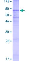 Human KCNJ11 / Kir6.2 Protein (Recombinant GST)
