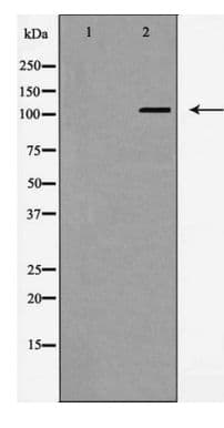 Polyclonal Rabbit anti-Human EPHA4 / EPH Receptor A4 Antibody (WB)
