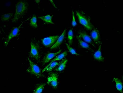 RBBP6 Antibody (aa51-97)