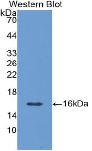 CALCB Antibody (aa1-134)