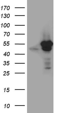 VRK2 Antibody (aa301-486, clone OTI2F5)