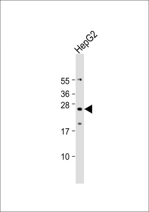 Polyclonal Rabbit anti-Human TMBIM4 / GAAP Antibody (WB)