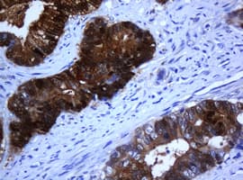 Monoclonal Mouse anti-Human Selenium Binding Protein 1 Antibody (clone OTI3A3, IHC, WB)