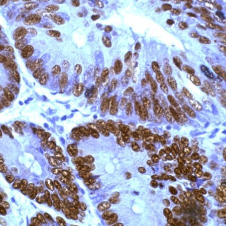 Polyclonal Rabbit anti-Human TP53 / p53 Antibody (IHC)
