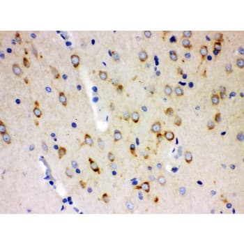 ABI1 / SSH3BP1 Antibody (aa151-175)