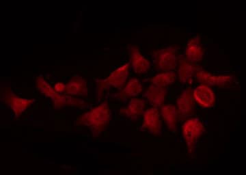 PKNOX2 Antibody