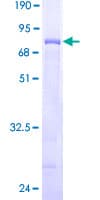 Human WDFY1 Protein (Recombinant GST)