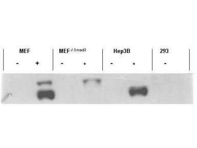 Polyclonal Rabbit anti-Human SMAD3 Antibody (phospho-Ser423/425, IHC, WB)