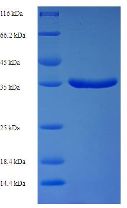 Sheep TGFA / TGF Alpha Protein (Recombinant GST)
